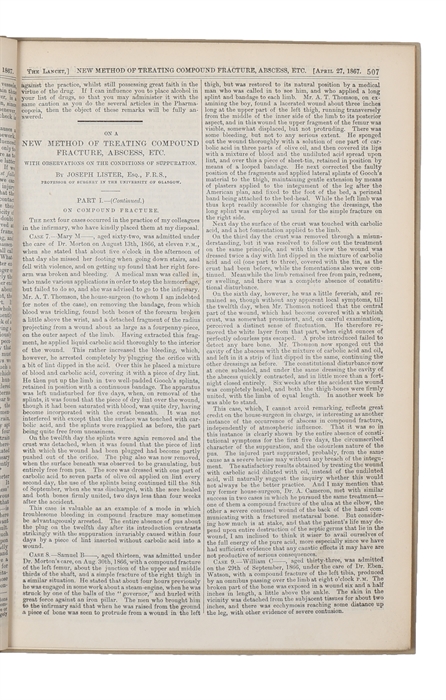 A New Method of Treating Compound Fracture, Abscess, etc. With Observations on the Conditions of Suppuration. Part I. On Compound Fracture - Part I (continued) - Part I (continued) - Part I (continued) - (Part II) New Method of Treating Compound Fract...