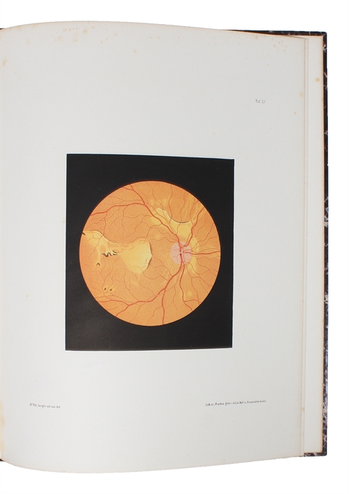 Beiträge zur Pathologie des Auges. Mit Abbildungen im Farbendruck. Textbd. + Atlas.