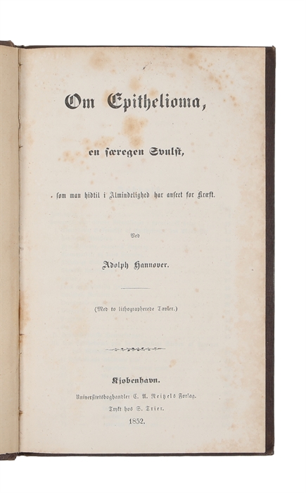 Om Epithelioma, en særegen Svulst. Med to lithographerede Tavler. 